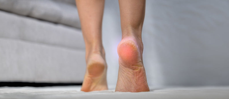 Get Relief from Diabetes Cracked Heels