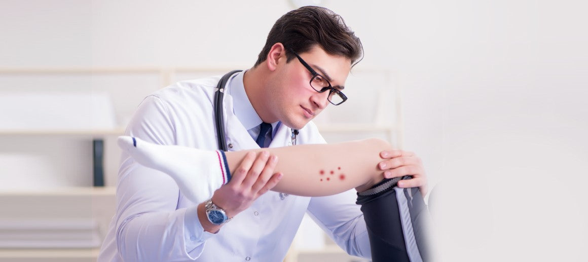 Understanding Diabetic Dermopathy