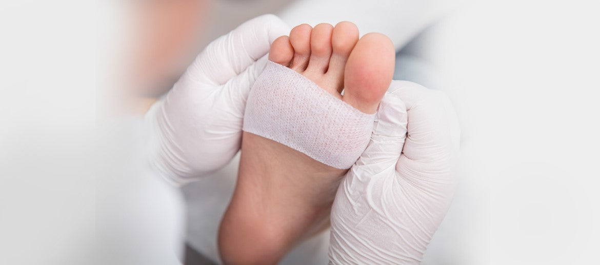 What Causes a Diabetic Foot Ulcer and How to Prevent One